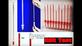 Erythrocyte Sedimentation Rate ESR Test [upl. by Ajay]