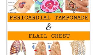 PERICARDIAL TAMPONADE amp FLAIL CHEST [upl. by Dett]