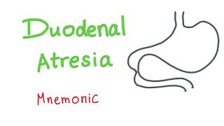 Duodenal Atresia Mnemonic [upl. by Desdamonna730]