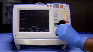 R Series Pacing Software prior to v 14 [upl. by Eirehs]