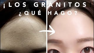 Los Granitos¿Qué hago [upl. by Adnima]