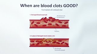 Anticoagulants [upl. by Alleahcim]