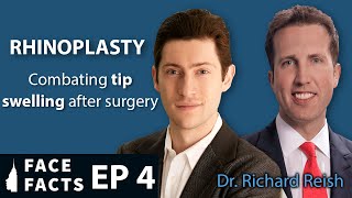 How to Combat Tip Swelling after Rhinoplasty  Dr Gary Linkov [upl. by Botti]