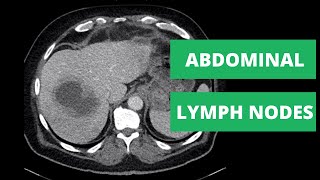 How to explore lymph nodes on ENT [upl. by Su]