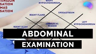 Abdominal Examination  OSCE Guide Latest  UKMLA  CPSA  PLAB 2 [upl. by Navert]