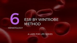 ESR by Wintrobe Method [upl. by Anerol]