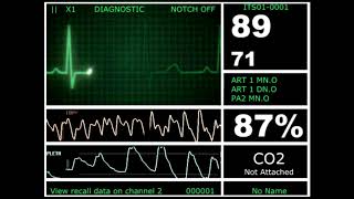 Hospital Monitor with FlatLine L HD [upl. by Torrey786]