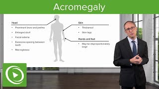 Acromegaly – Endocrinology  Lecturio [upl. by Kallick]