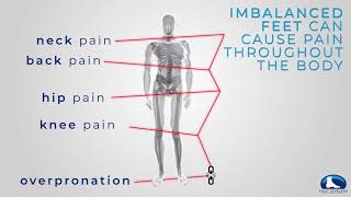 Overpronation and the footspine connection [upl. by Brier]