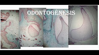 Embriología dentaria Odontogénesis [upl. by Aiepoissac]