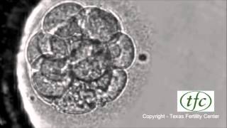 Human Embryo Growing from Fertilization to Day 6 Blastocyst [upl. by Nnylarak]