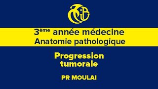 3eme année médecine Anatomie pathologique Progression tumorale [upl. by Yenaj]