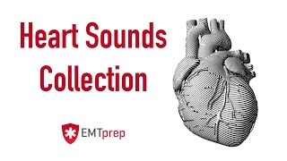 Normal Sinus Rhythm  EKG ECG Interpretation [upl. by Anahpos]