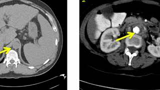 Introduction to Radiology Computed Tomography [upl. by Vitkun581]