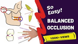 Balanced Occlusion Made Easy  PROSTHODONTICS [upl. by Evoy]