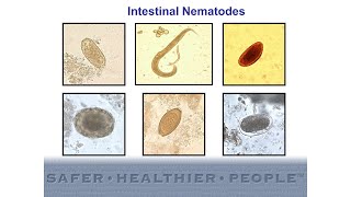 Diagnostic Features of Intestinal Nematodes [upl. by Jorrie557]