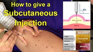 How to Give a Subcutaneous Injection Video [upl. by Fania]