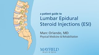 Lumbar Epidural Steroid Injections [upl. by Seppala488]