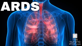 Acute Respiratory Distress Syndrome ARDS [upl. by Lash]