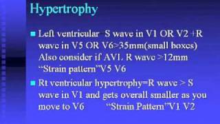 ECG Course 1 [upl. by Nattirb]