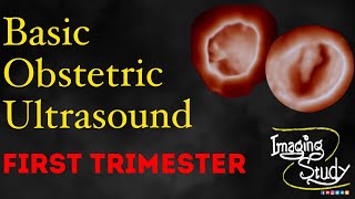 Basic Obstetric Ultrasound First Trimester Pregnancy [upl. by Ettelrats]