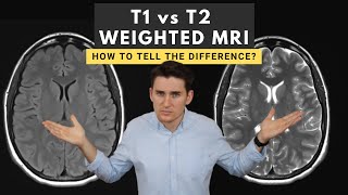 T1 vs T2 weighted MRI images How to tell the difference [upl. by Portland]