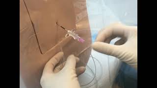 Neuraxial Task Trainer Demonstration  Epidural Anesthesia [upl. by Clarhe800]