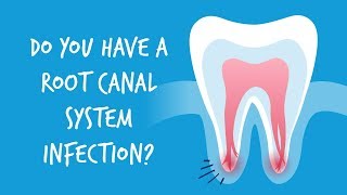 Do You Have a Root Canal System Infection [upl. by Amitie]