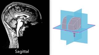 MRI  3D Brain Anatomy Internal Capsule Thalamus amp Brainstem [upl. by Celik]