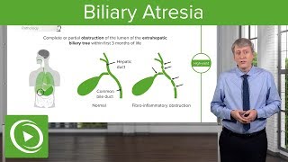 Biliary Atresia – Pediatrics  Lecturio [upl. by Onabru]