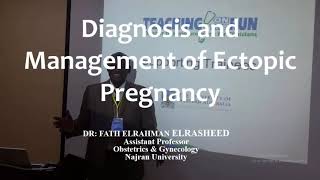 RCOG Guidelines Diagnosis and Managment of Ectopic Pregnancy [upl. by Jansen]