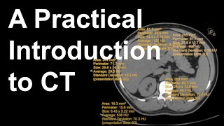 A Practical Introduction to CT [upl. by Auqenes343]