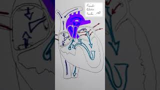 Tricuspid Atresia CHD Shorts [upl. by Ancel]