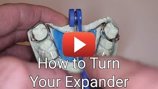 How to Turn Your Expander [upl. by Alyl]