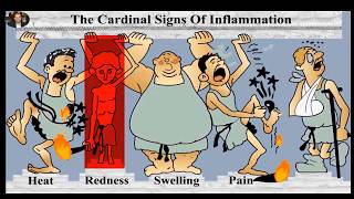 Cardinal signs of inflammation Prostaglandins and Leukotrienes [upl. by Adnowal563]