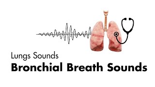 Bronchial Breath Sounds  Lung Sounds  Medzcool [upl. by Danielson]