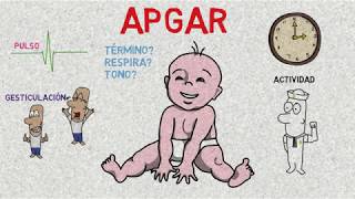 Test de APGAR  Calificación de APGAR [upl. by Gemini]