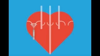 Afib Aflutter Junctional Arrhythmias  ECG EKG Interpretation Part 4 [upl. by Eimam45]