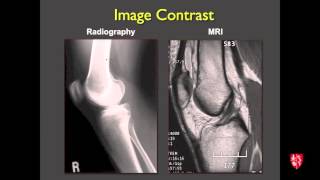 Medical Student Lecture Introduction to Musculoskeletal Imaging [upl. by Ylremik735]