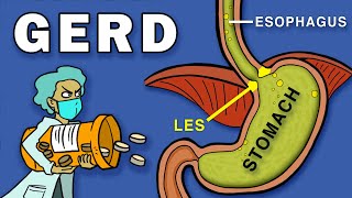 Esophageal Sphincters  Anatomy [upl. by Narud]