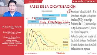 CIRUGÍA  Heridas y Cicatrización  ENAM 2020 [upl. by Netsoj]