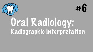 Oral Radiology  Radiographic Interpretation  INBDE ADAT [upl. by Llij]