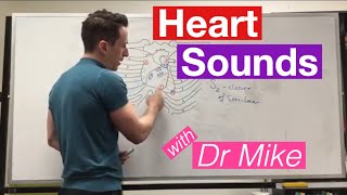 S1 Heart Sound  Learn How to Auscultate Part 8 [upl. by Akeemahs]