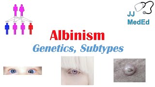 Albinism  Genetics Different Types and What You Need to Know [upl. by Suellen458]