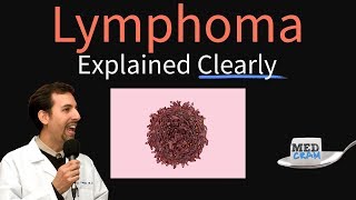 Mayo Clinic Minute Understanding and treating lymphoma [upl. by Tserof870]