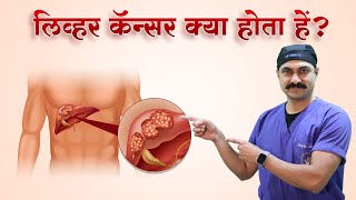 सोरायसिस का पूरा इलाज  Permanent Cure for Psoriasis  Dr Rohit Batra  In Hindi [upl. by Gnourt]