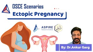 Ectopic pregnancy  OSCE Scenarios  Aspire Education  PLAB2 [upl. by Nnazus]