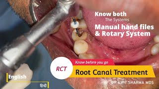 How Root canal treatment  RCT is done  Know both Manual and Rotary system [upl. by Ojyllek]