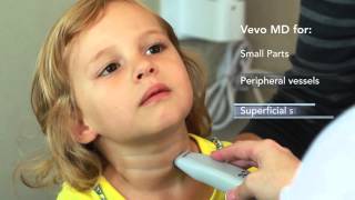 Ultra High Frequency Ultrasound for Clinical Use  the new Vevo MD [upl. by Mirielle]