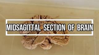 Midsagittal Section of Brain  neuroanatomy [upl. by Fifine]